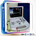 Dawei DW-C60 PLUS Farbdoppler Ultraschall Scanner PW und 3D Funktion